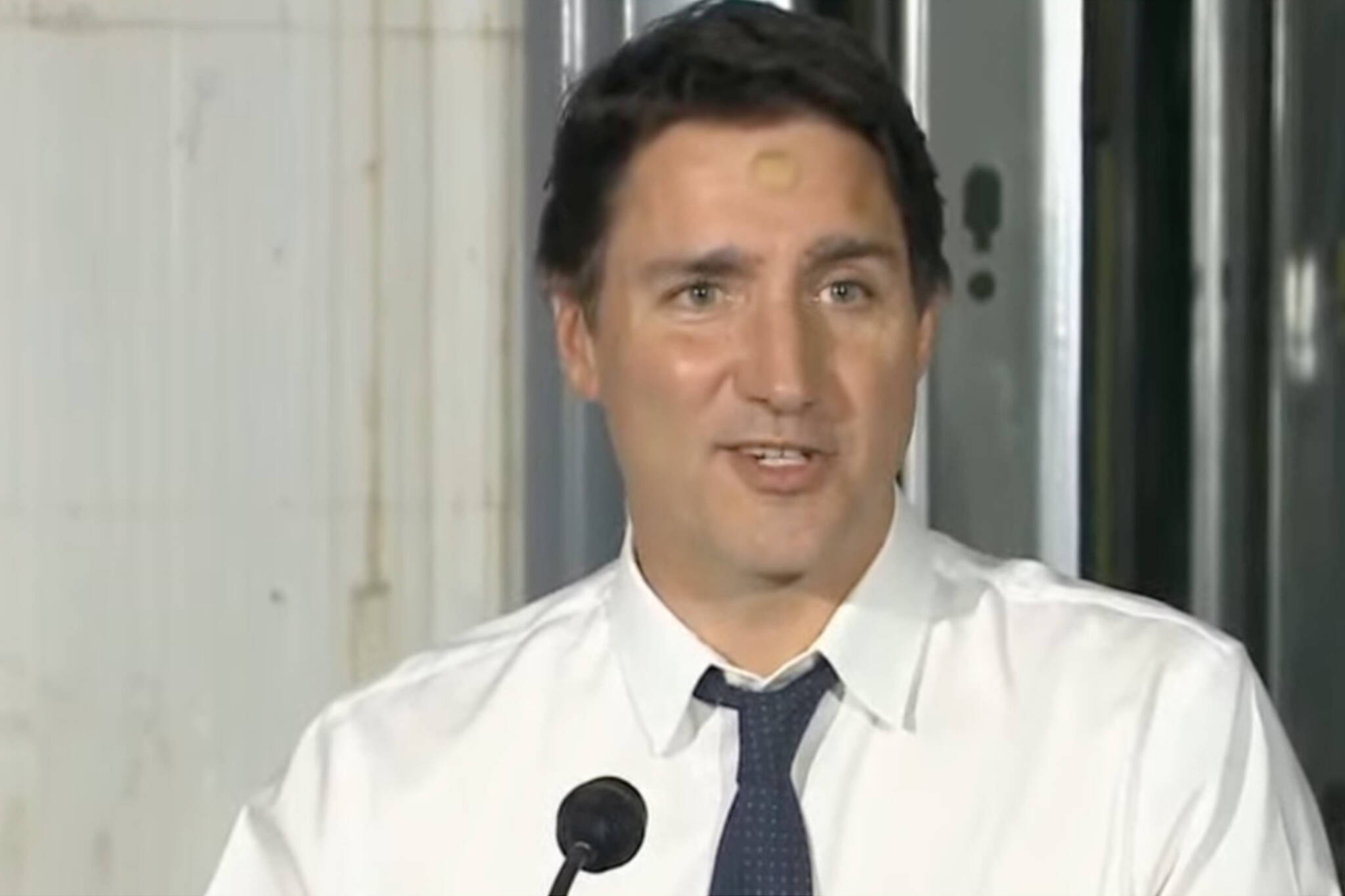 Canadians wonder what happened to Justin Trudeau's forehead
