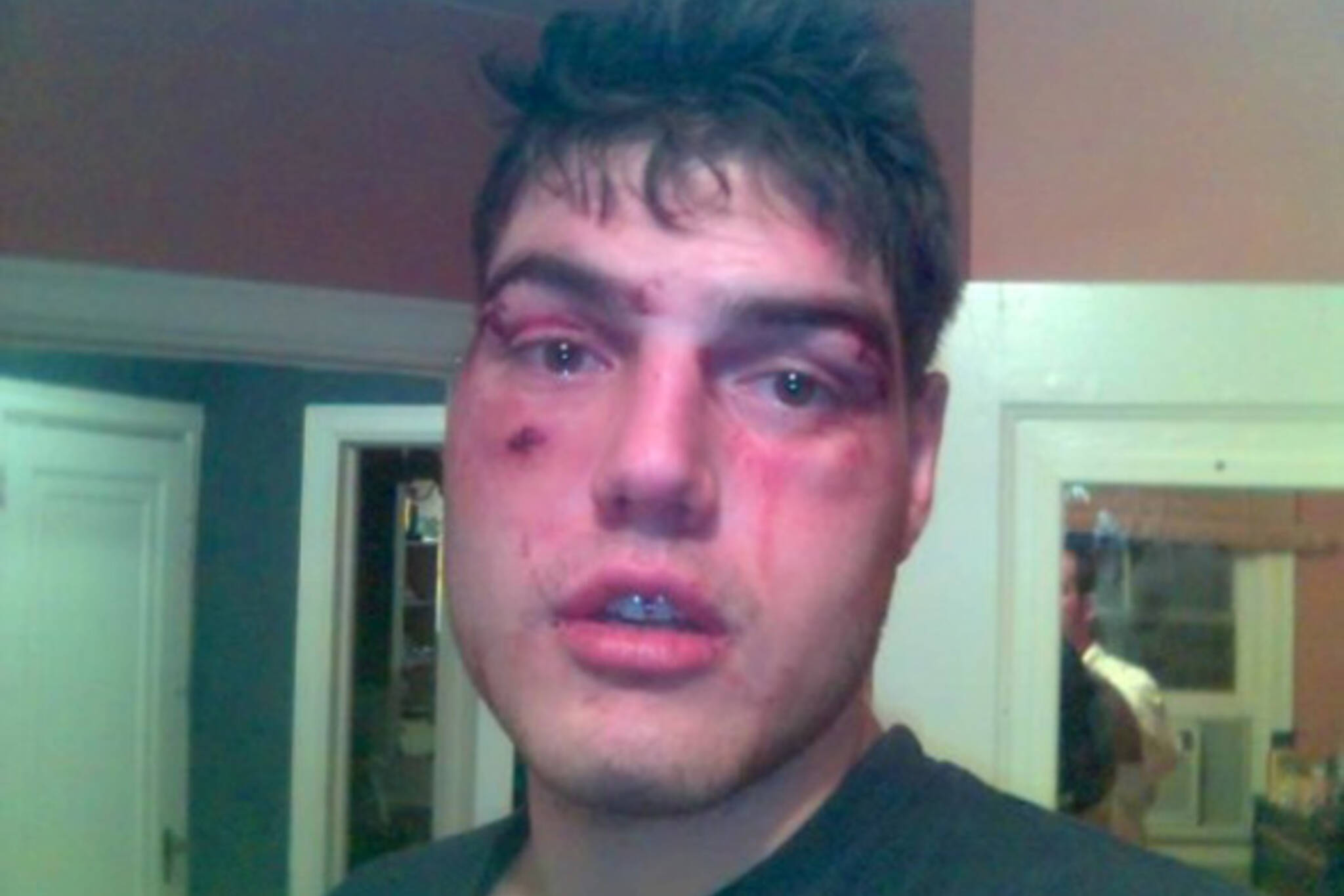 Toronto nightclub bouncers allegedly beat up Barry Ward