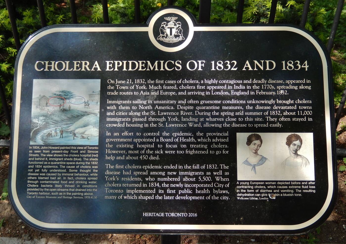 cholera toronto